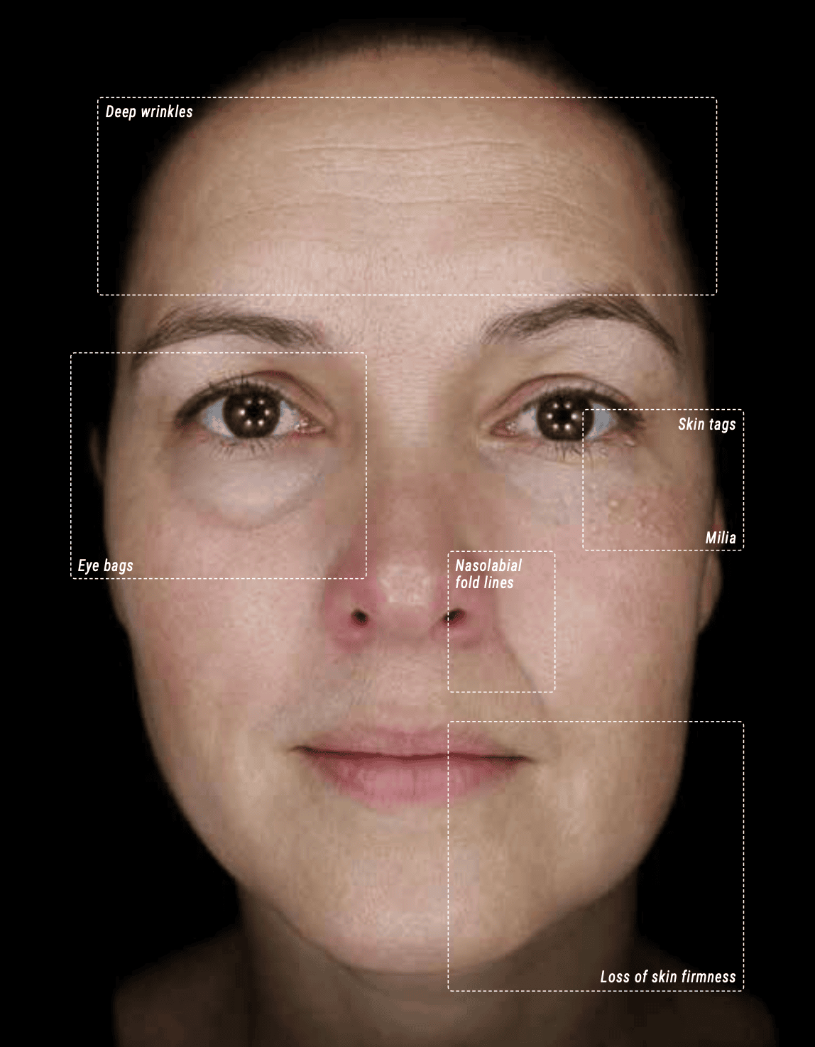 Facial Scan of Daylight light