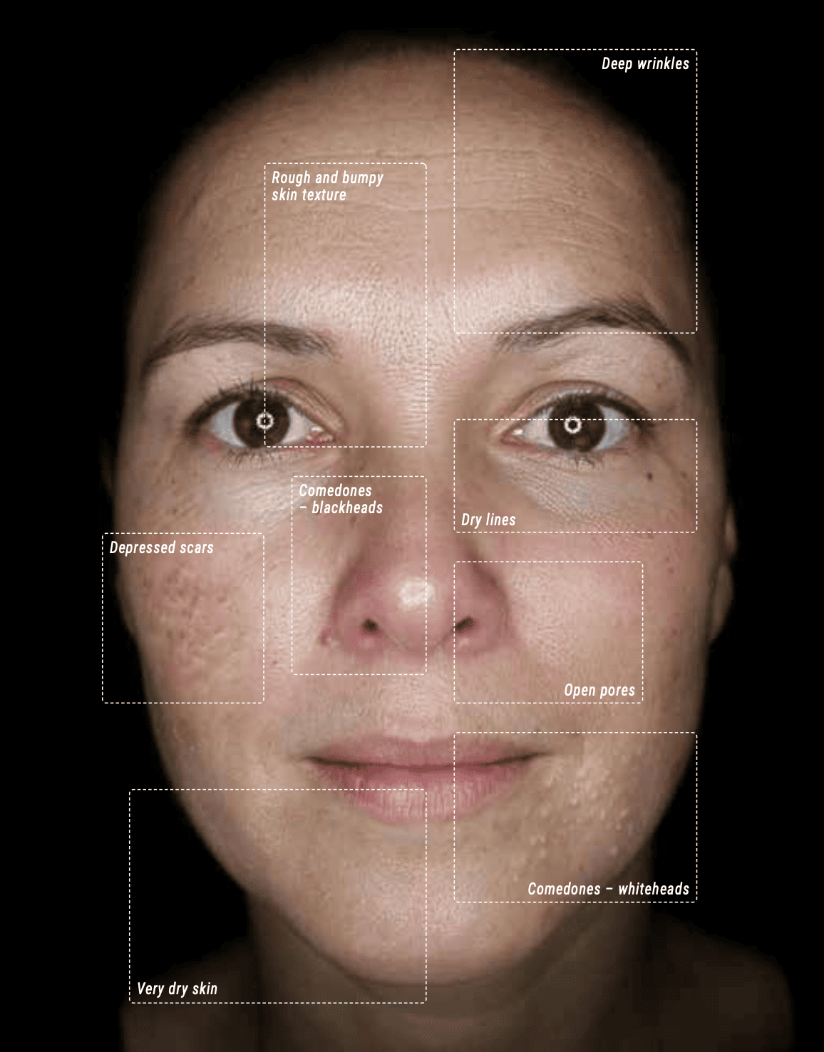 Facial scan to display parallel polarized light