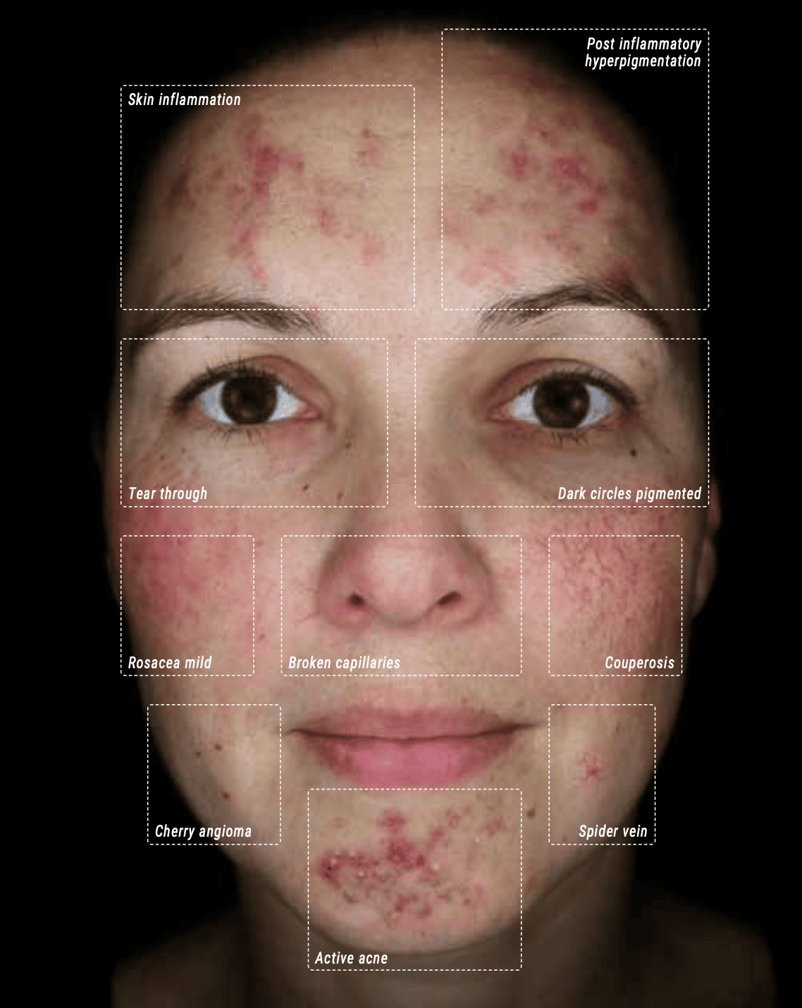 Facial scan with Cross Polarization