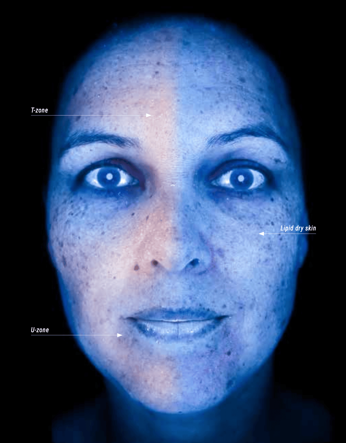 Facial Scan with Woods