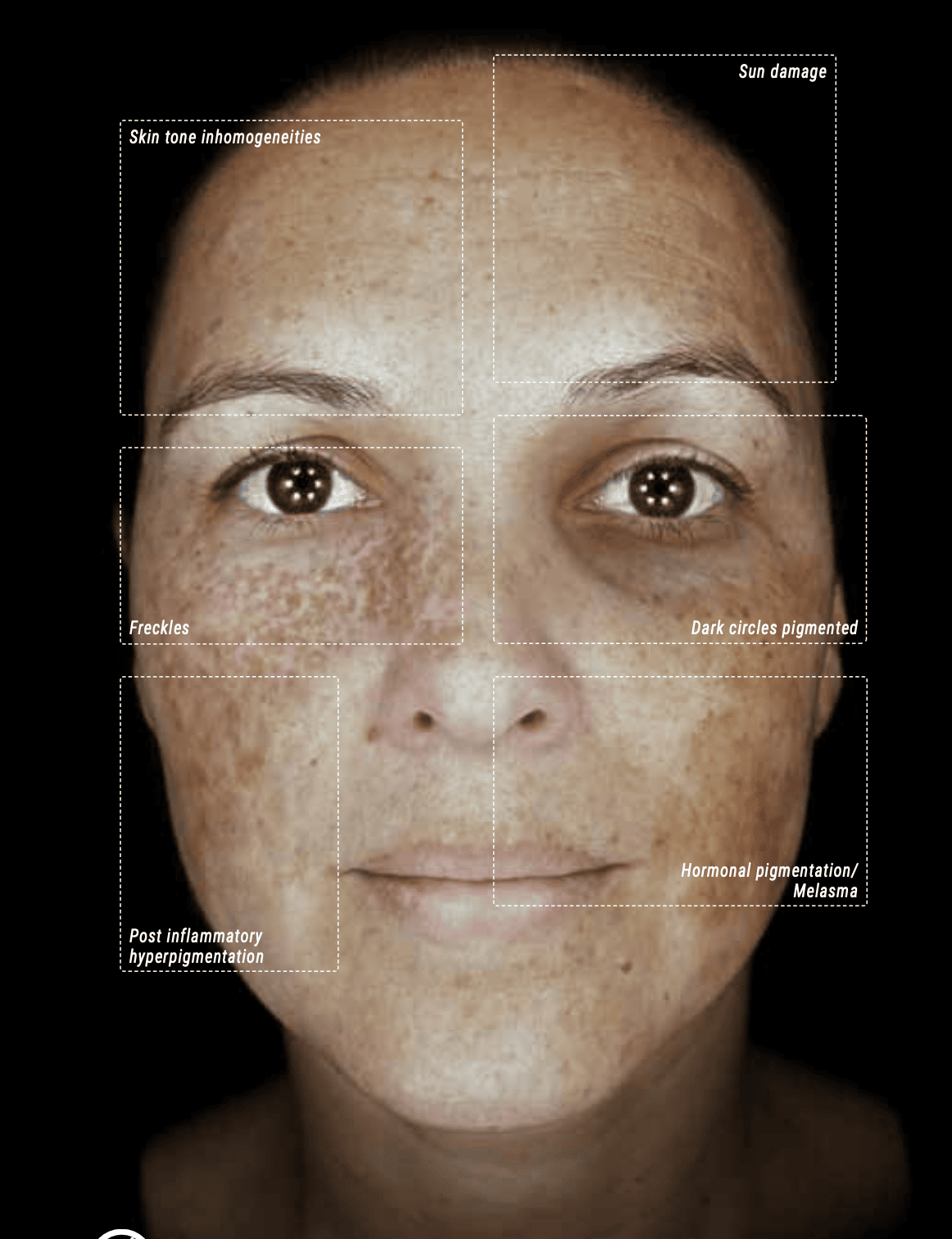 Facial Scan displaying Pigmentation