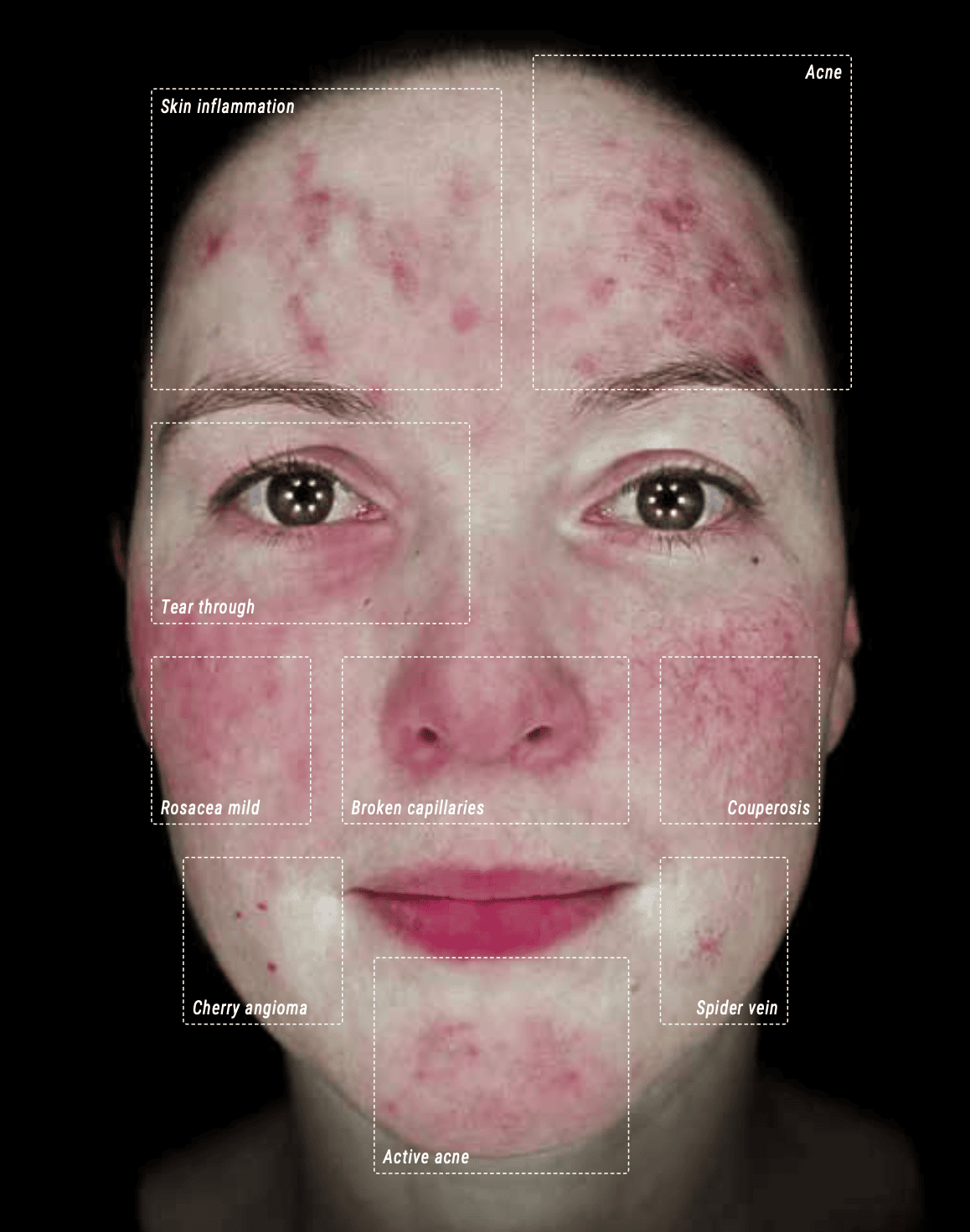 Image scan to display Vascularity